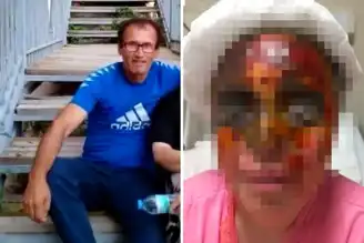Kezzaplı Saldırı: Kadın İki Gözünü Kaybetti!