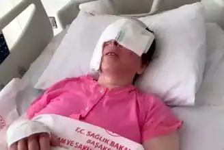 Kezzap Saldırısı: Kadın Görme Kaybı Yaşıyor