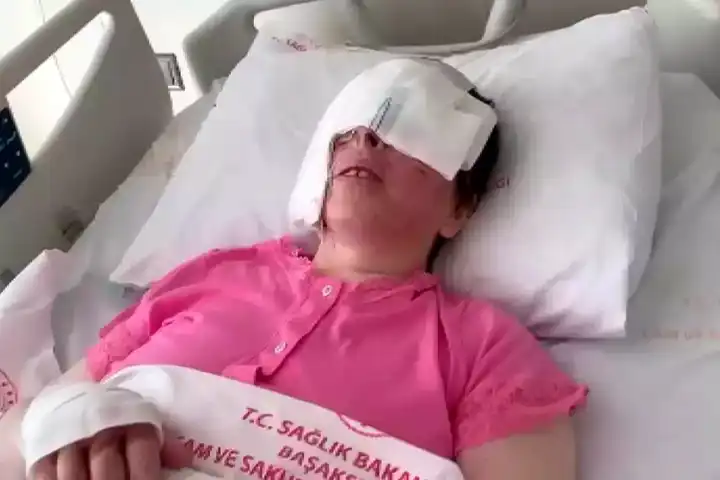 Kezzap Saldırısı: Kadın Görme Kaybı Yaşıyor